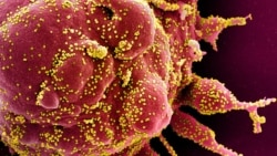 Colorized scanning electron micrograph of an apoptotic cell (red) infected with SARS-COV-2 virus particles (yellow), isolated from a patient sample. National Institute of Allergy and Infectious Diseases, NIH/Handout via REUTERS. 